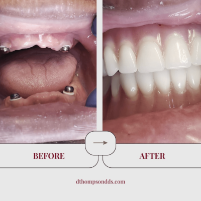 thompson-social-3 thompson-social-3